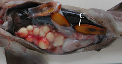 stage3b1