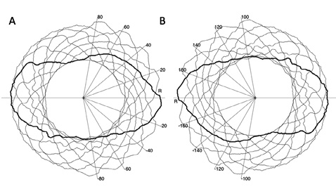 figure4