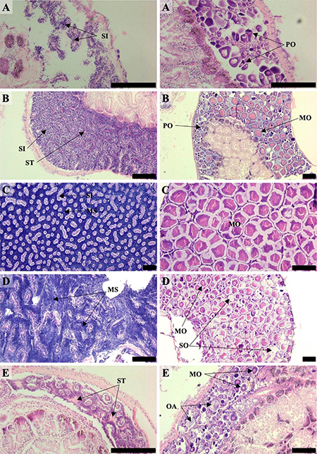 Histological sections displaying the gonad maturity stages in males (left) and females (right) of Phorcus lineatus from the Algarve coast (southern Portugal): A, pre-active; B, active; C, ripe; D, partially spent; E, spent. Abbreviations: MO, mature oocytes; MS, mature spermatozoa; OA, oocyte atresia; PO, previtellogenic oocytes; SI, spermatids; SO, spawned oocyte; ST, spermatozoa tails. Scale bars: 200 µm.