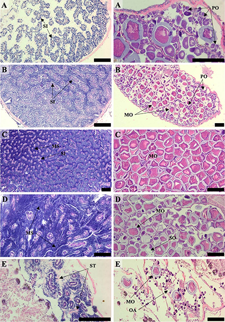 Histological sections displaying the gonad maturity stages in males (left) and females (right) of Phorcus sauciatus from the Algarve coast (southern Portugal): A, pre-active; B, active; C, ripe; D, partially spent; E, spent. Abbreviations: MO, mature oocytes; MS, mature spermatozoa; OA, oocyte atresia; PO, previtellogenic oocytes; SI, spermatids; SO, spawned oocyte; ST, spermatozoa tails. Scale bars: 200 µm.