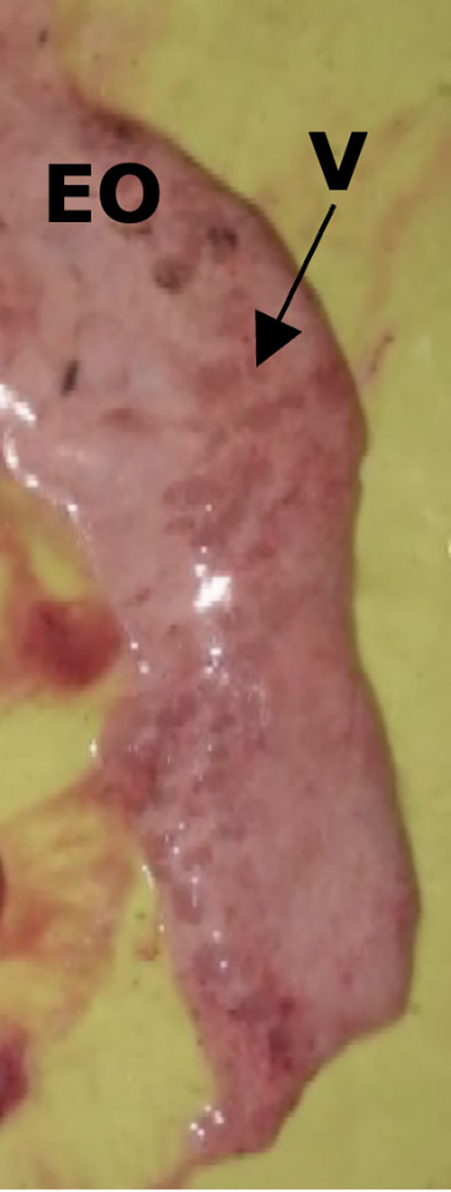 Se observa un órgano o tejido biológico con etiquetas que indican EO y una flecha señalando una zona marcada como V sobre un fondo amarillo.

Descripción generada con IA